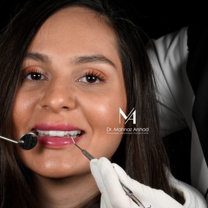 معرفی درمانهای زیبایی دندان ها