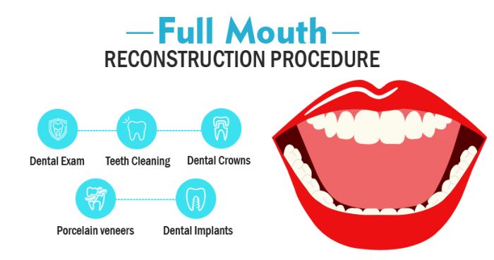بازسازی کامل دهان و دندان