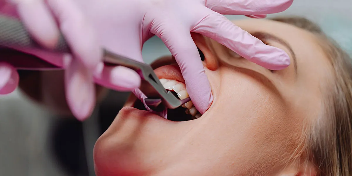 آیا باز شدن سینوس حین کشیدن دندان خطرناک است؟