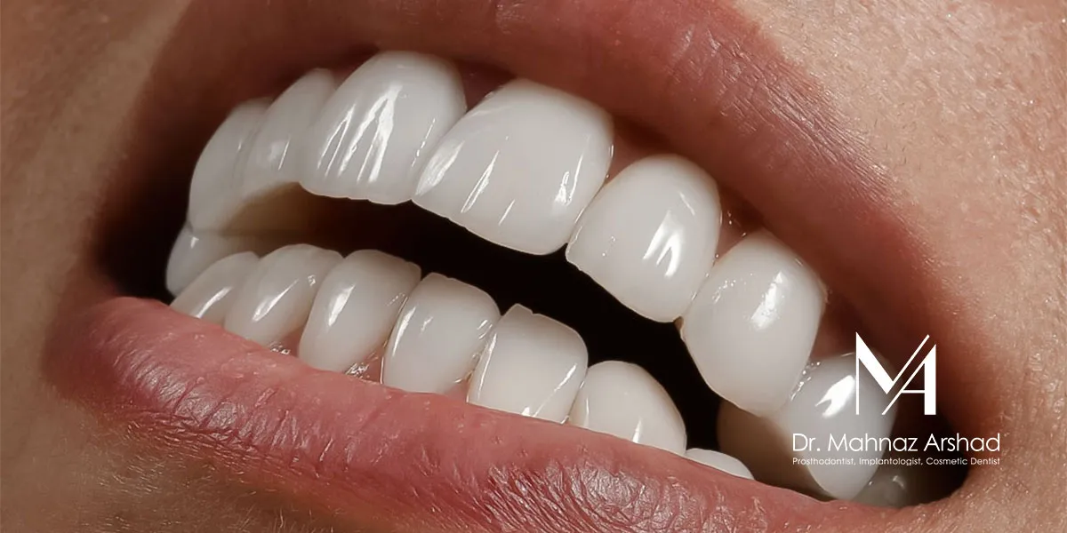آیا کامپوزیت دندان برای شما مناسب است؟