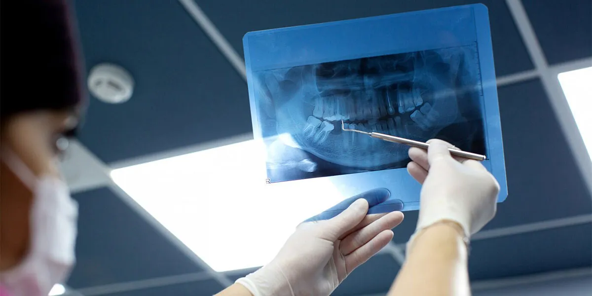 مراحل ایمپلنت دندان معاینه اولیه