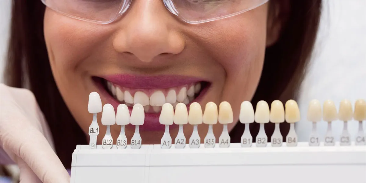 انواع رنگ لمینیت دندان