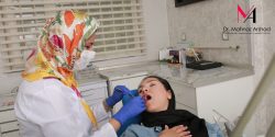 ایمپلنت دندان در مطب دکتر مهناز ارشد