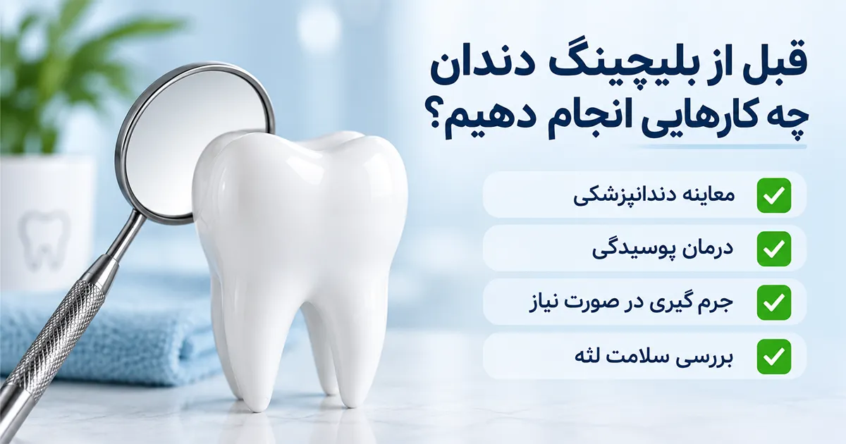 قبل از بلیچینگ دندان چه کارهایی انجام دهیم؟