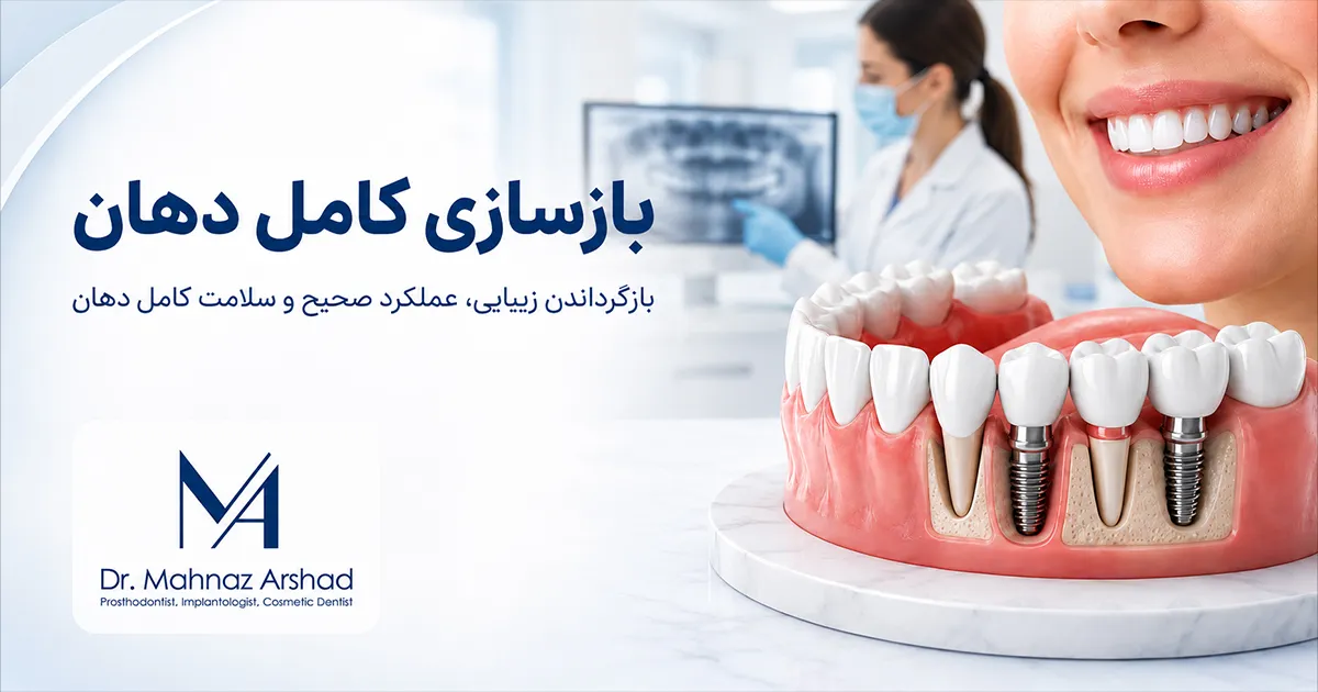 بازسازی کامل دهان و دندان