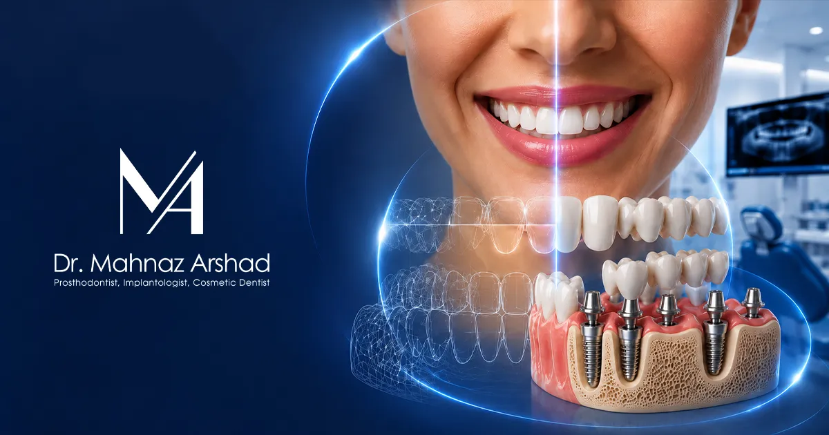 بازسازی کامل دهان با اصلاح طرح لبخند