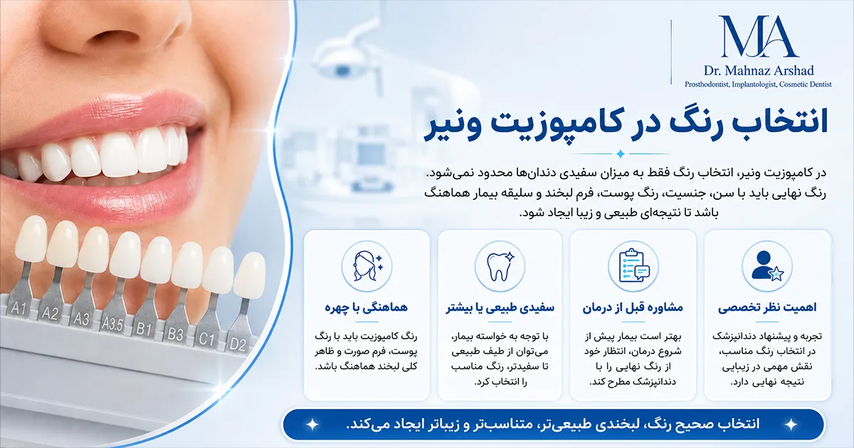 رنگ کامپوزیت دندان