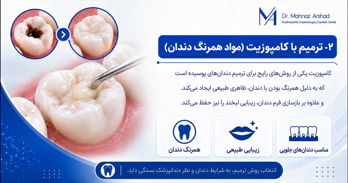 ترمیم دندان با کامپوزیت