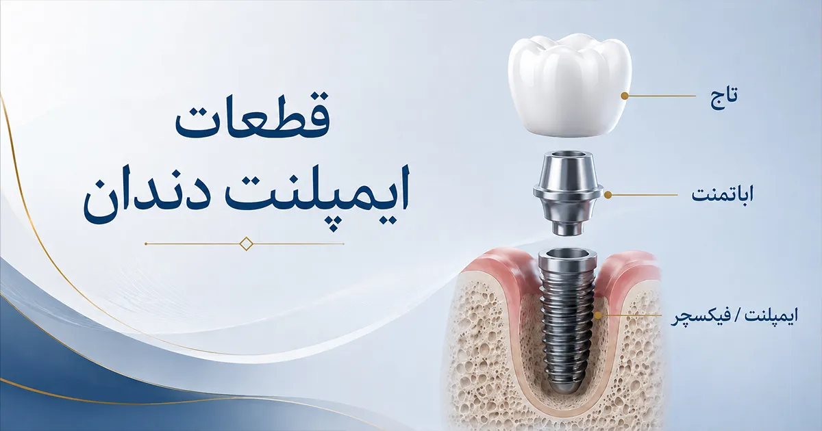 قطعات ایمپلنت