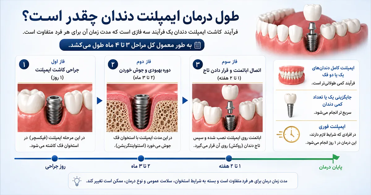 طول درمان ایمپلنت دندان