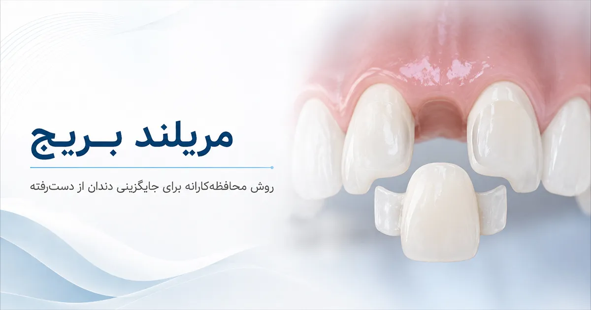 مریلند بریج