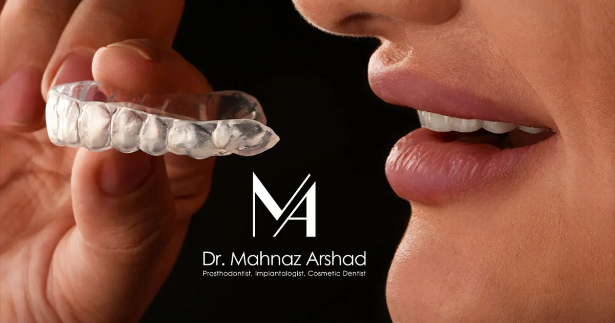 کلیک یا صدا دادن مفصل فک