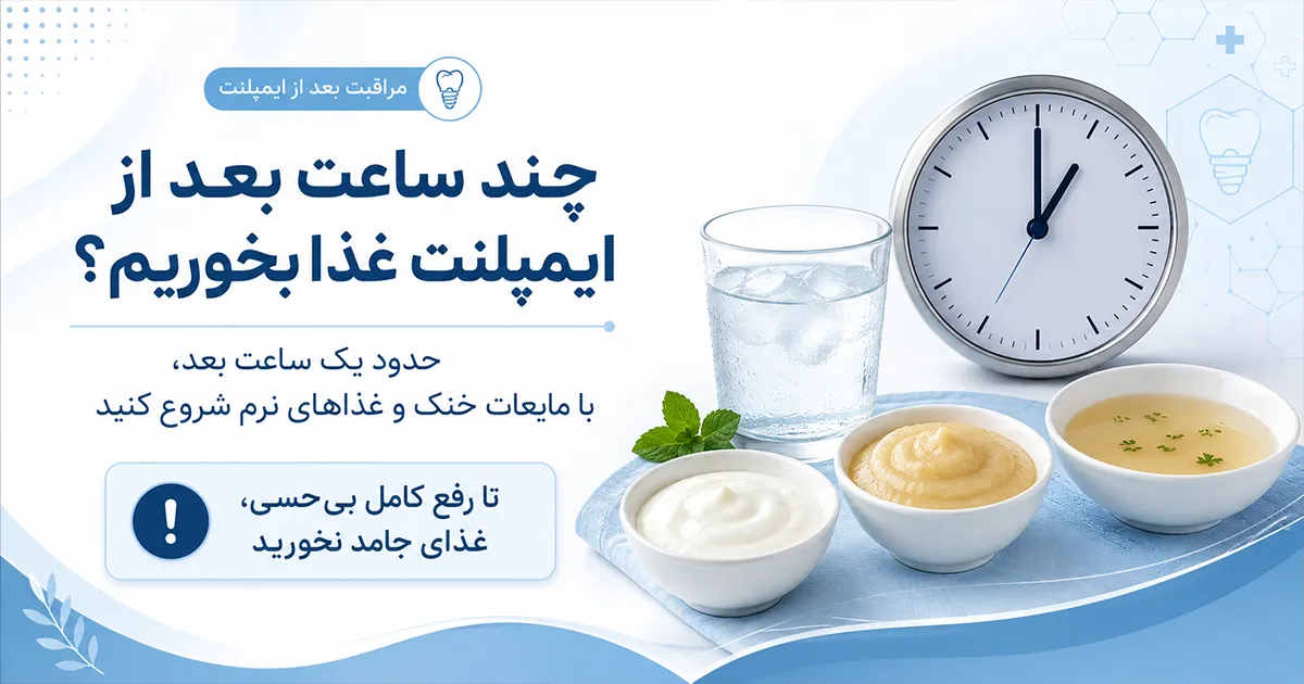 چند ساعت بعد از ایمپلنت غذا بخوریم؟