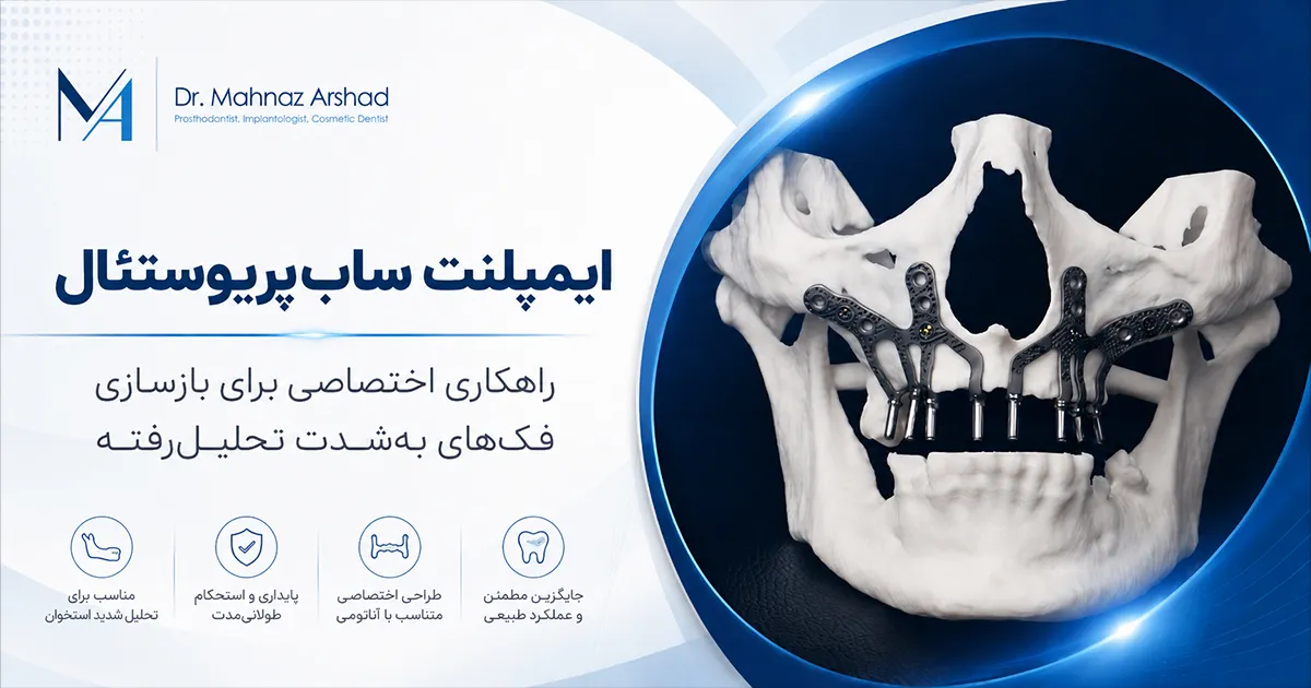 ایمپلنت های مخصوص SPI