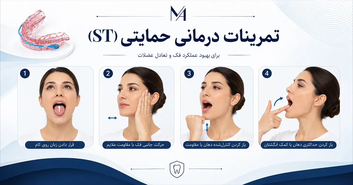 تمرینات درمانی حمایتی خروپف
