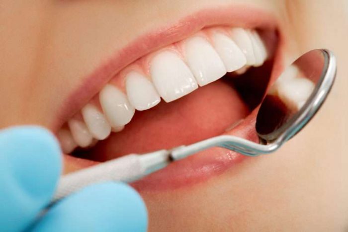 رعایت بهداشت دهان و دندان­ها