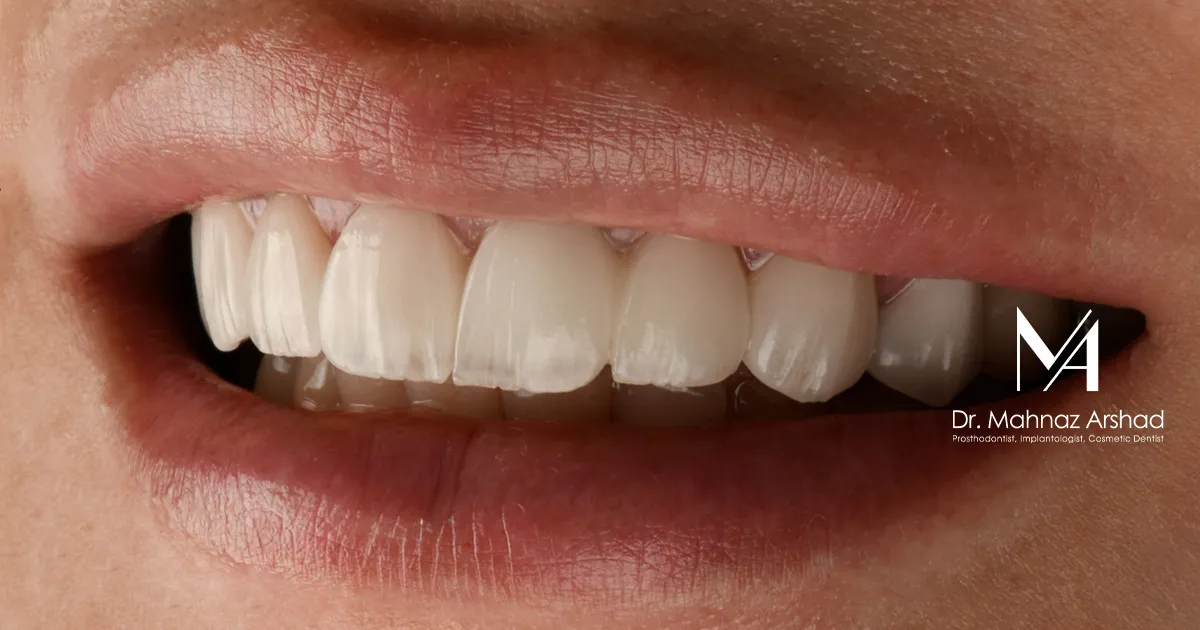 دندانپزشکی زیبایی Esthetic dentistry