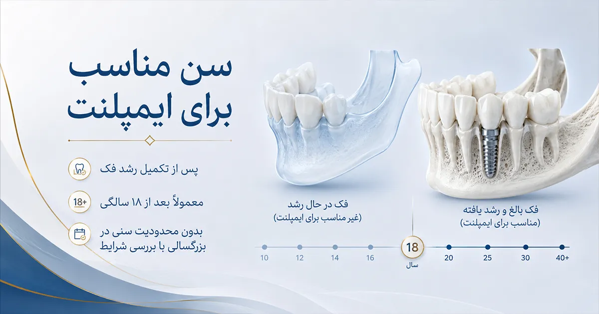 سن مناسب ایمپلنت