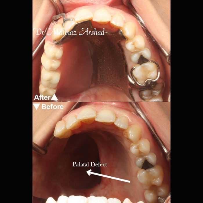 درمان آسیب های داخل دهانی ویا خارج دهانی