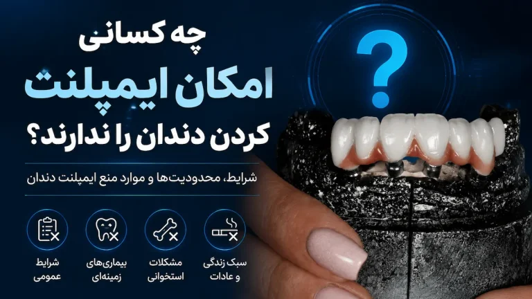 چه کسانی امکان ایمپلنت کردن دندان را ندارند؟