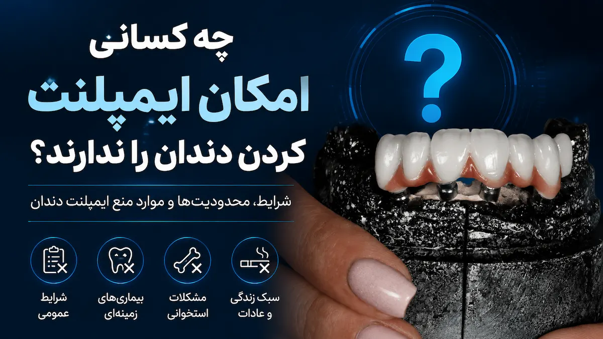 چه کسانی امکان ایمپلنت کردن دندان را ندارند؟