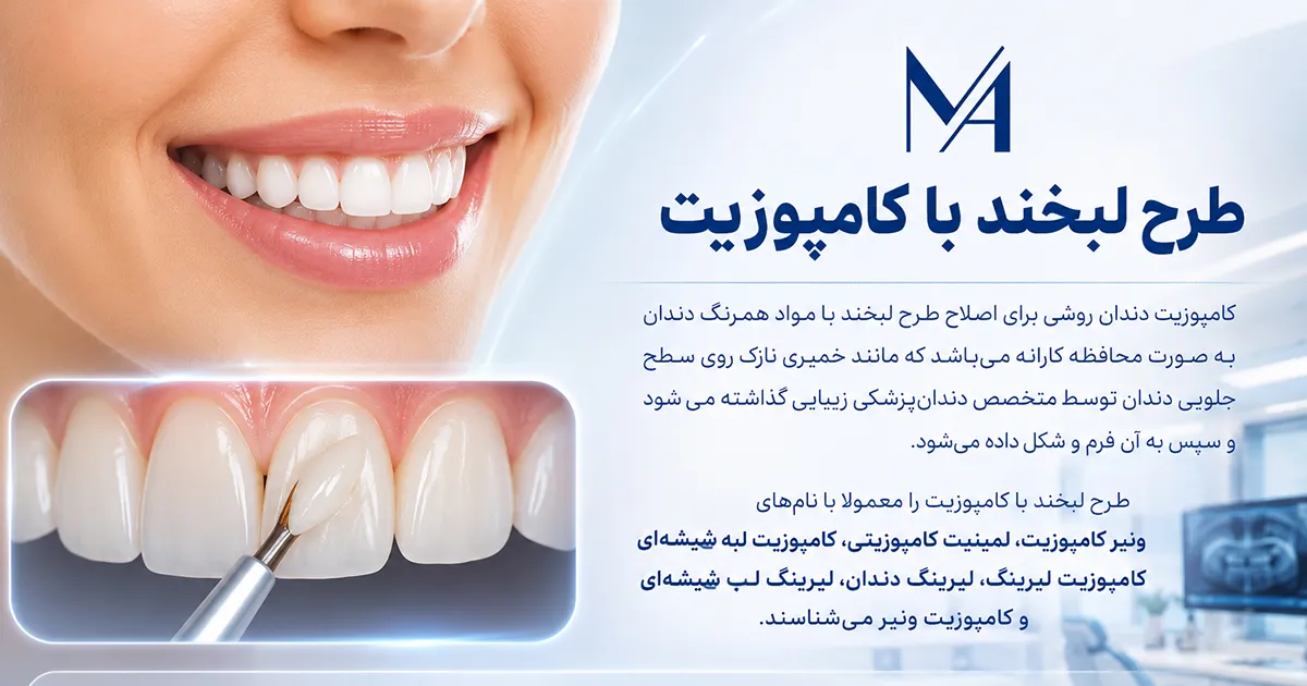 کامپوزیت دندان چیست؟