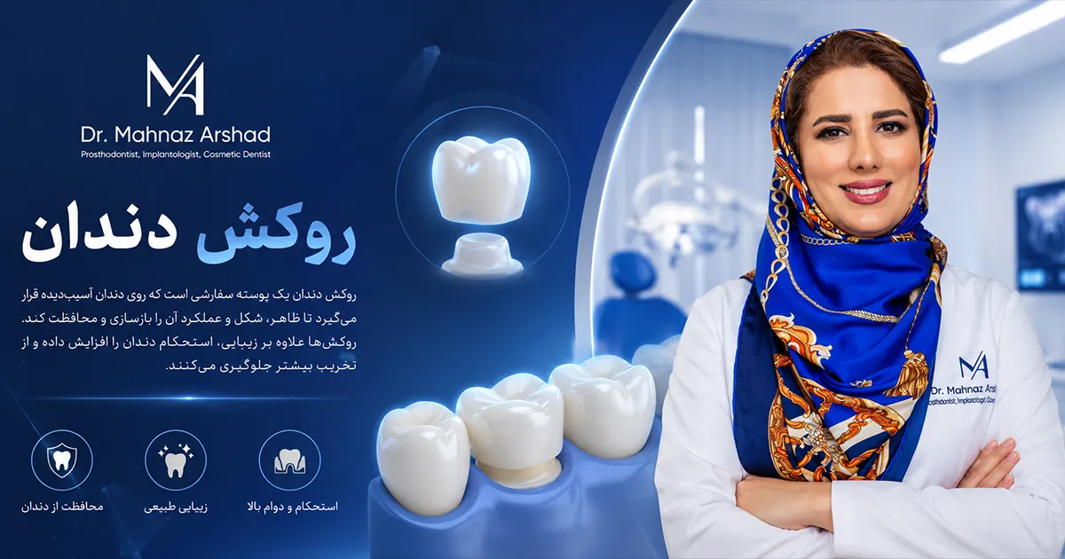 روکش های دندانی