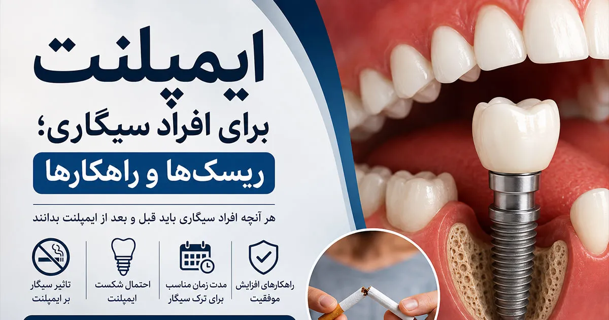 ایمپلنت دندان برای سیگاری ها