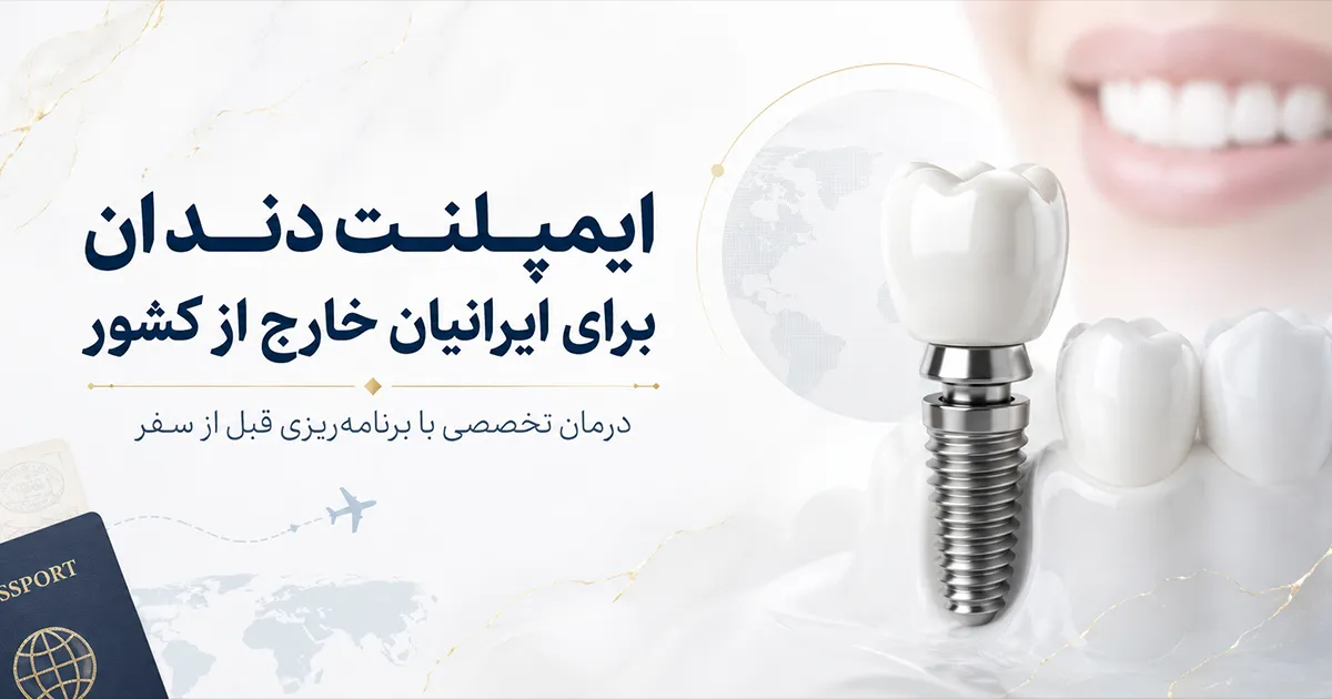  ایمپلنت دندان برای ایرانیان خارج از کشور درمان کامل در یک سفر برنامه‌ریزی‌شده به ایران