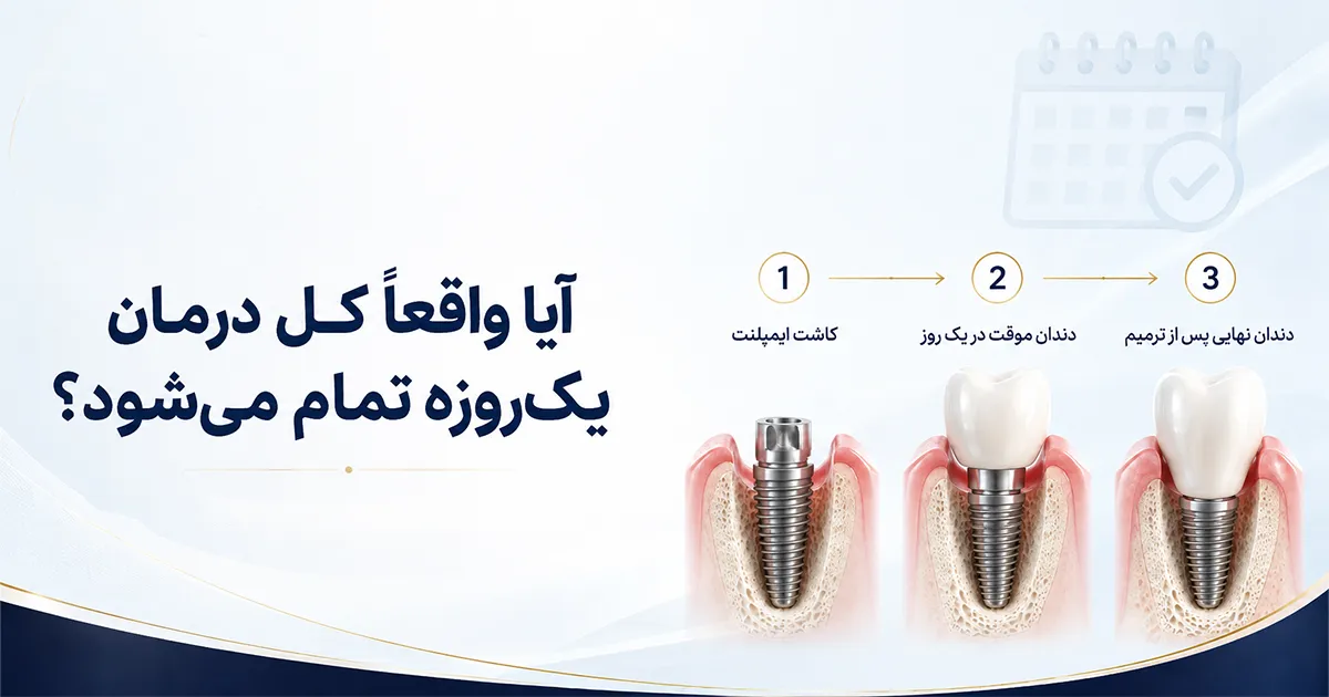 آیا واقعاً کل درمان ایمپلنت در یک روز تمام می ‌شود؟