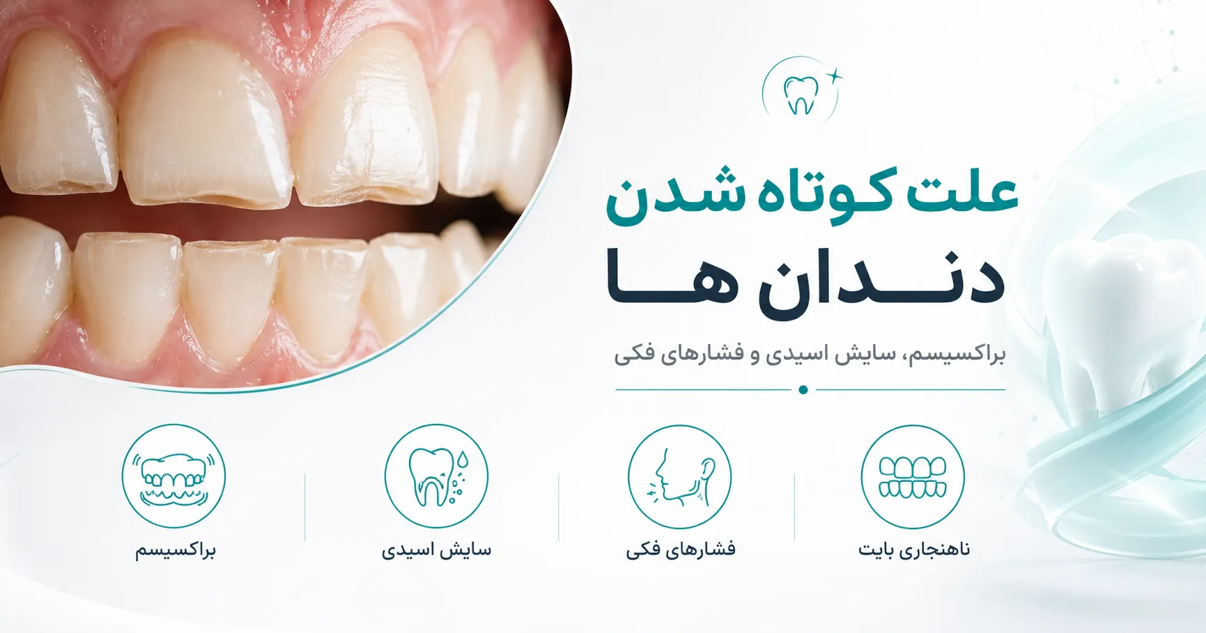 علت کوتاه شدن و ساییدگی دندان ها