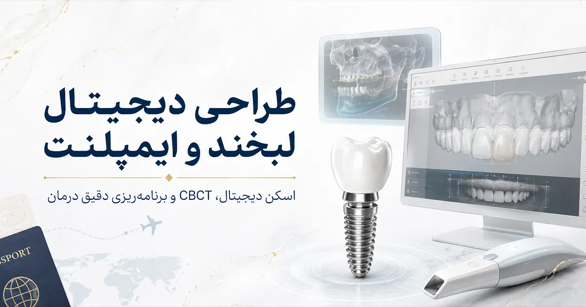 طراحی دیجیتال لبخند و ایمپلنت با تکنولوژی روز