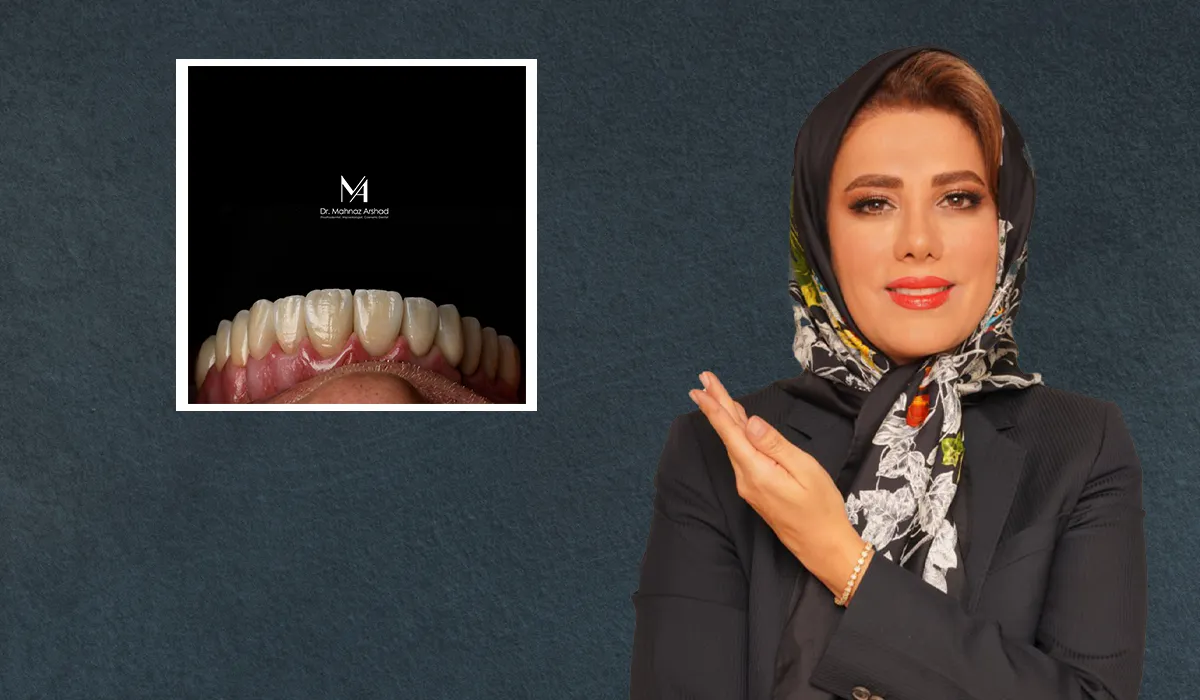 بهترین دندانپزشکی ایمپلنت