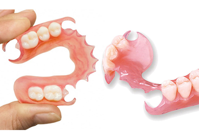 پروتز دندانی انعطاف‌پذیر (ژله ای)