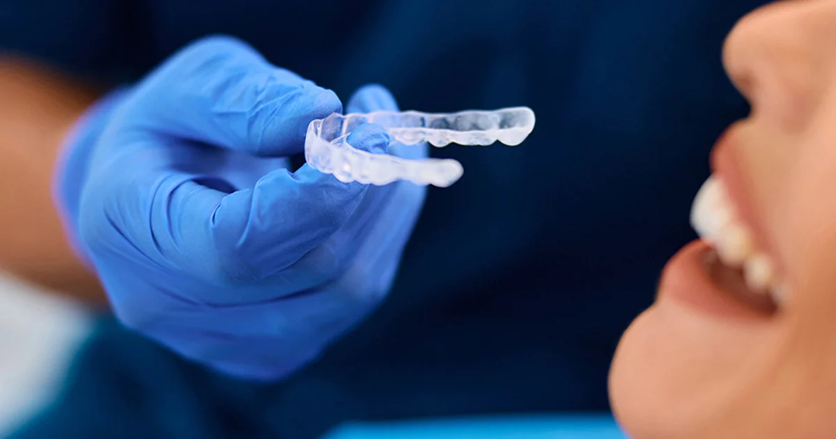 بلیچینگ خانگی