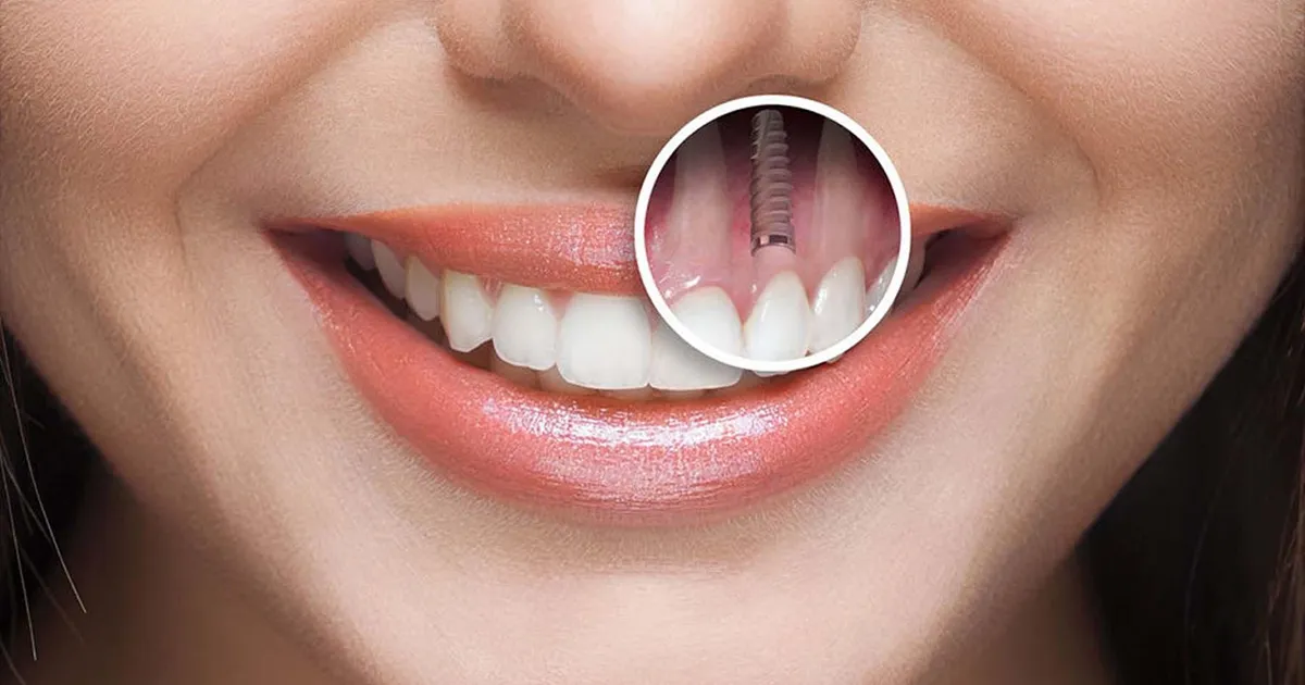 درمان بی ‌دندانی