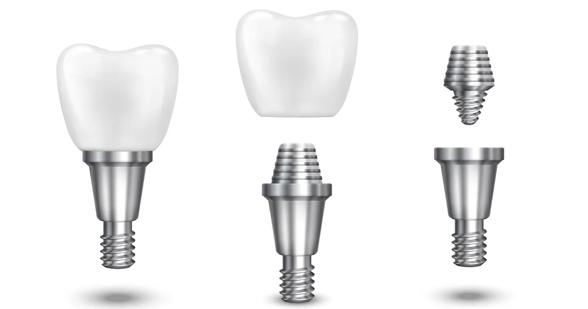 ترمیم ایمپلنت لق ‌شده یا دچار عفونت شده