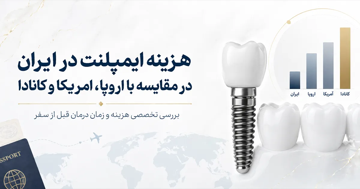 هزینه ایمپلنت در ایران در مقایسه با اروپا، آمریکا و کانادا