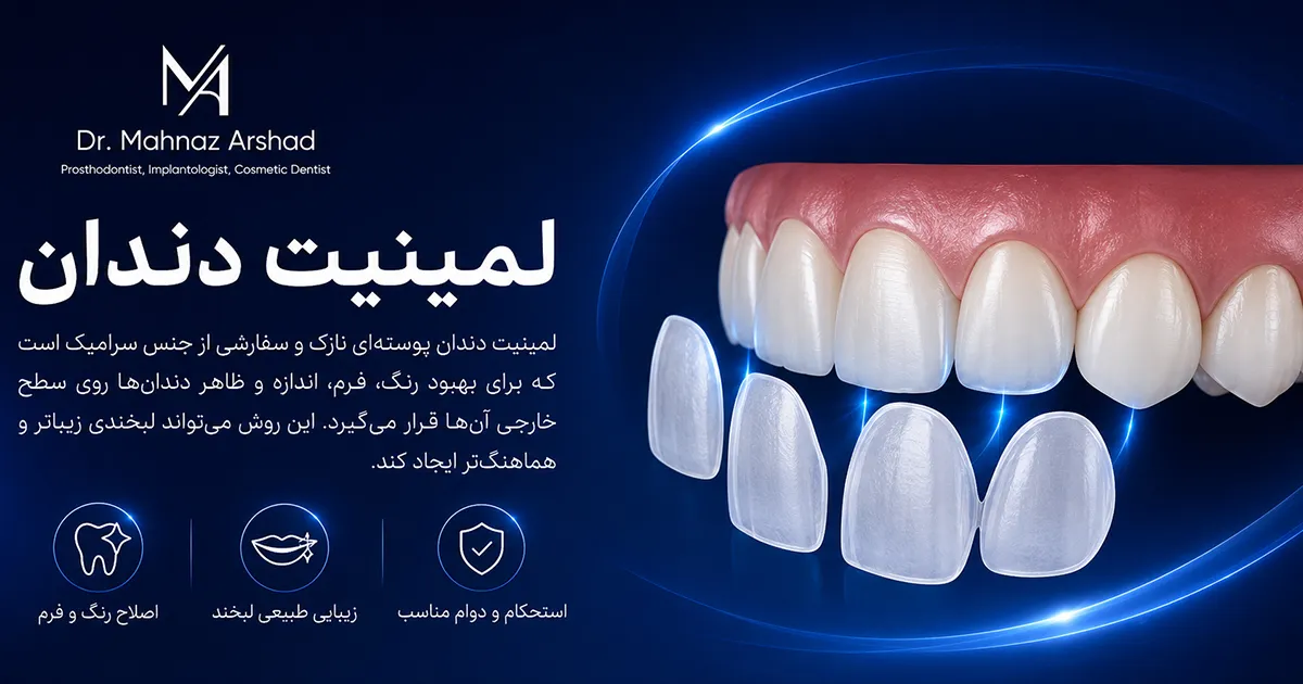 لمینیت دندان