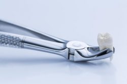 معرفی ابزارهای کشیدن دندان