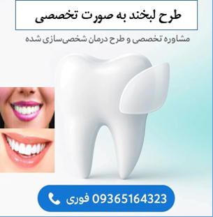 طرح لبخند تخصصی 