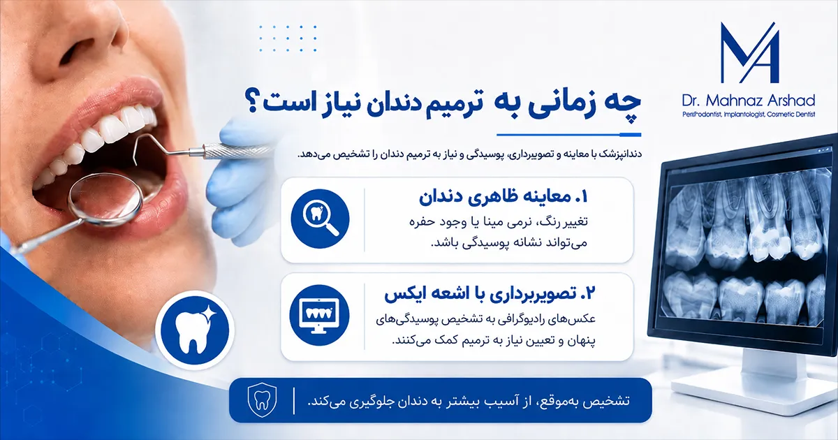 ترمیم دندان