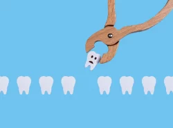 کشیدن دندان بر اثر آبسه