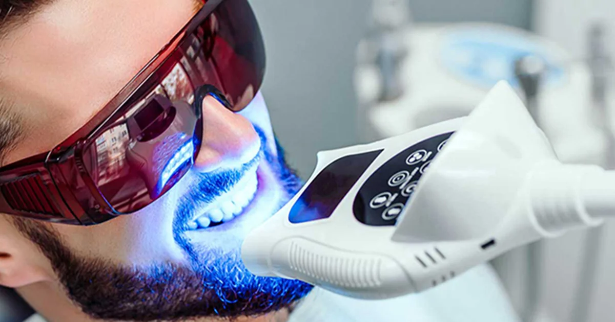 بلیچینگ دندان