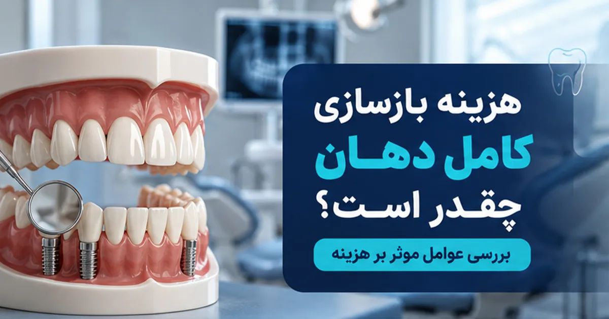 هزینه بازسازی کامل دهان چقدر است؟ (عوامل مؤثر)