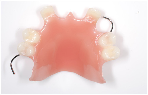 پروتز دندانی انعطاف پذیر