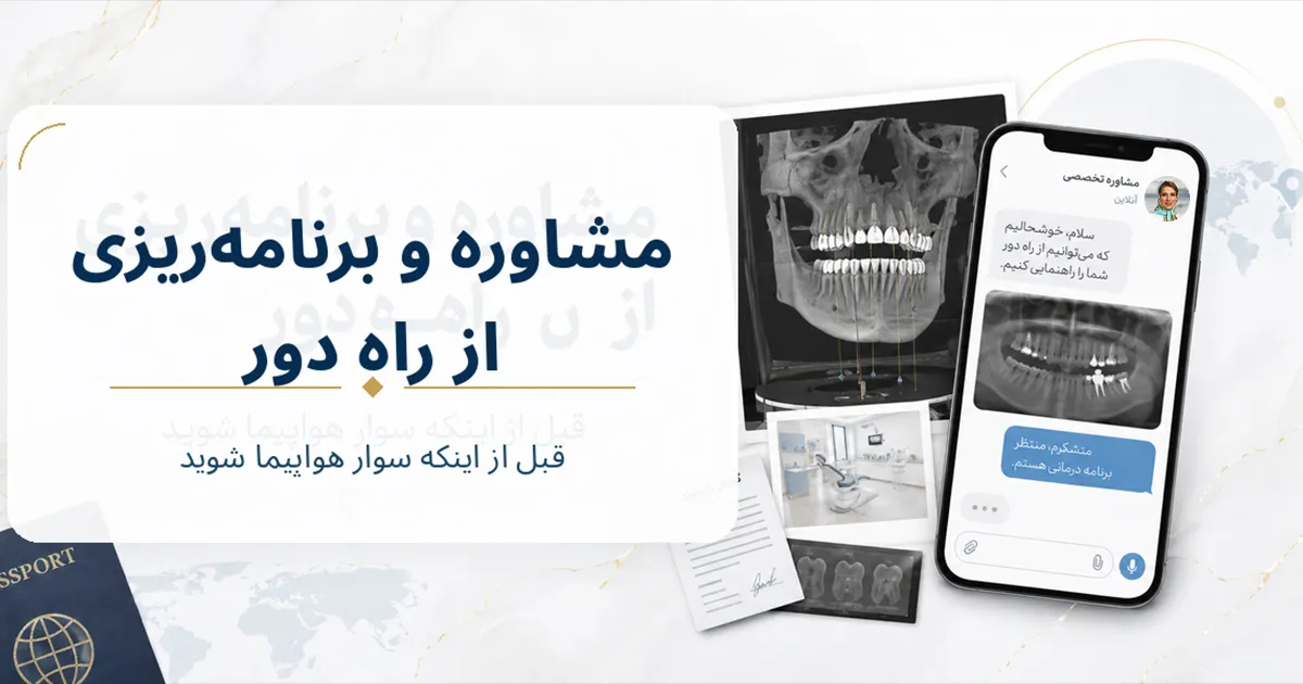 ایمپلنت فوری