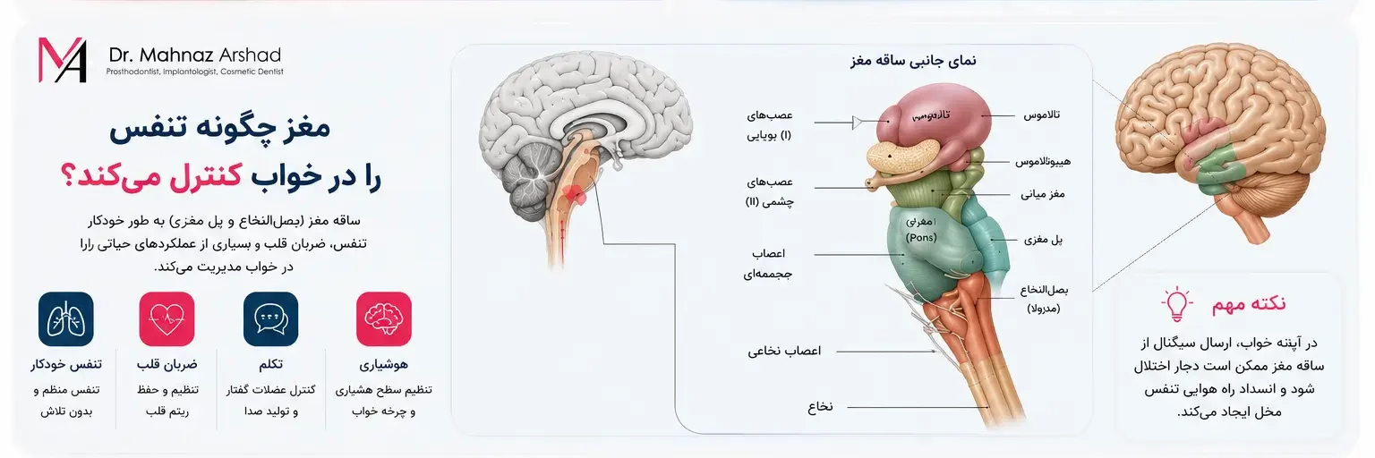 خروپف و آپنه
